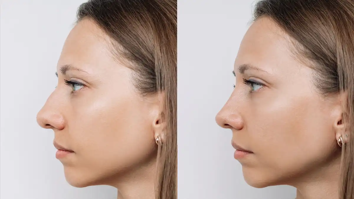 El valor de acudir al especialista adecuado DR. TONI ARCAS y MaxiloDexeus