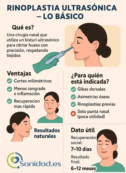la rinoplastia ultrasónica lo básico infografía