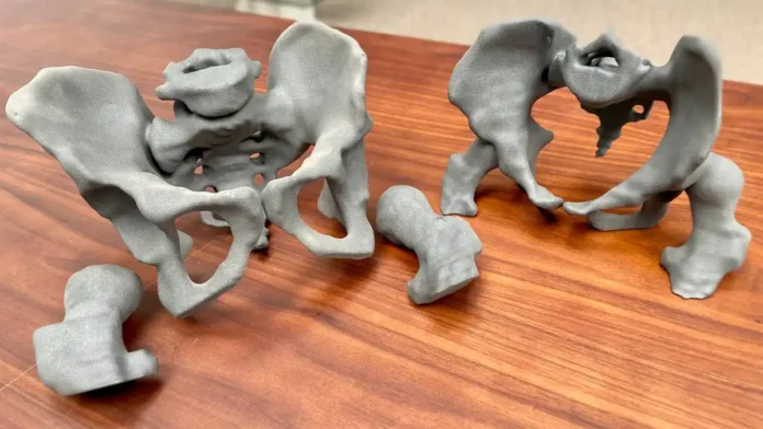 Modelos anatómicos impresos en 3D Modelos anatómicos impresos en 3D