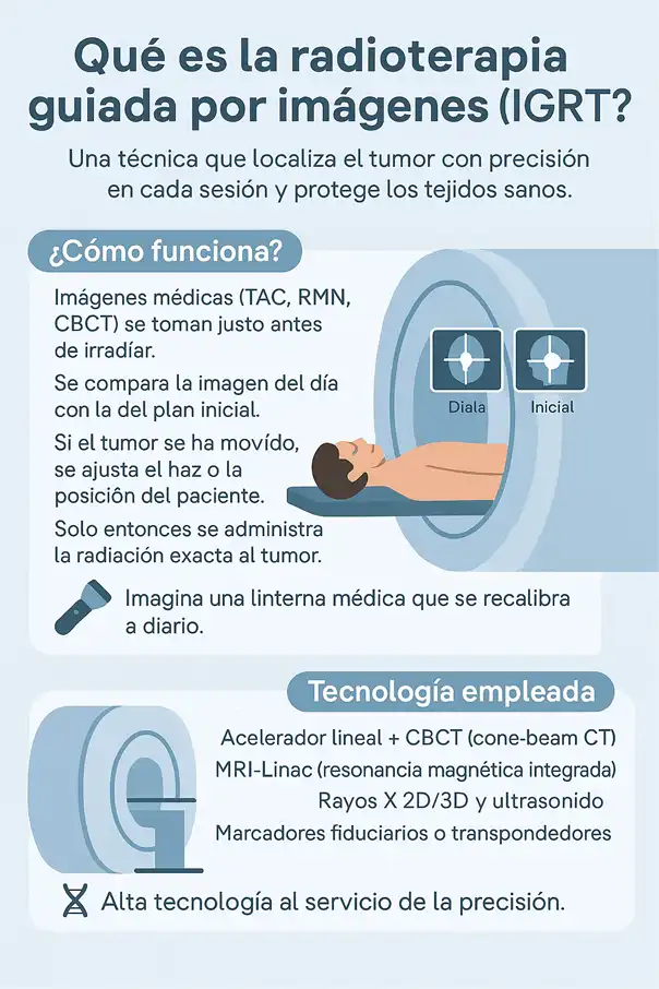 Qué es la radioterapia guiada por imágenes infografía