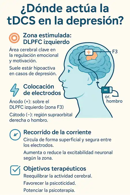dónde actua la tDCS en la depresión infografía