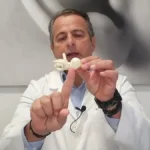 tratamiento innovador para acúfenos en España