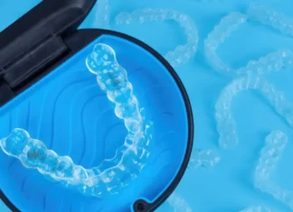 El peligro de la “ortodoncia de buzón”: una moda que puede dañar tu salud bucodental qué es la ortodoncia de buzón