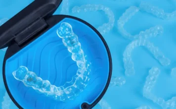El peligro de la “ortodoncia de buzón”: una moda que puede dañar tu salud bucodental qué es la ortodoncia de buzón