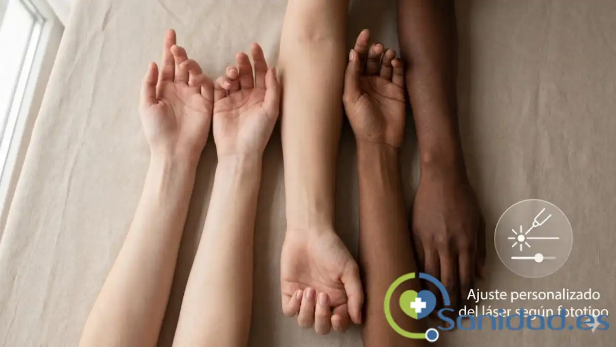 Fototipos y seguridad del láser diodo