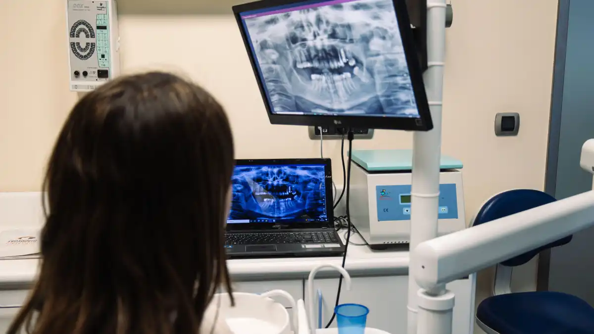 La planificación digital con radiografías 3D permite valorar la pérdida ósea y definir la técnica de implante más segura para cada paciente. Imagen cedida por Clínica Dental Censadent, para uso referencial.