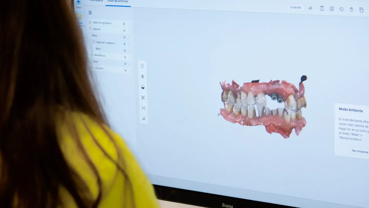 Implantes dentales en Palencia con Dentomedic