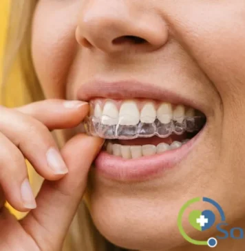 qué es la ortodoncia invisible y cuáles son sus ventajas