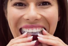 Ortodoncia invisible vs. Brackets_