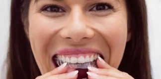 Ortodoncia invisible vs. Brackets_