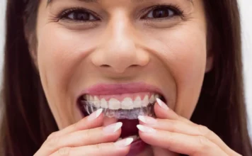 Ortodoncia invisible vs. Brackets_