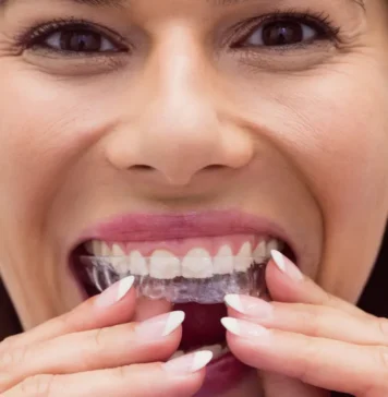 Ortodoncia invisible vs. Brackets_