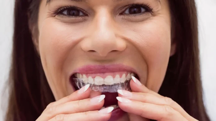 Ortodoncia invisible vs. Brackets_