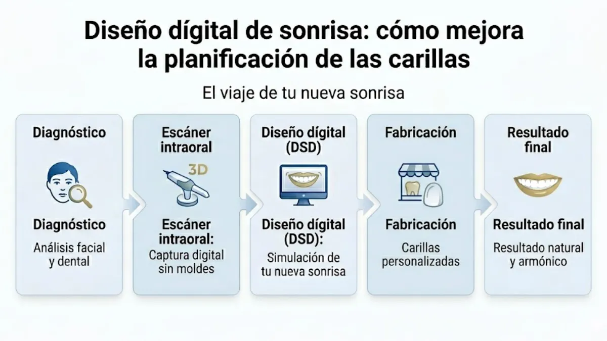 carillas dentales en Madrid