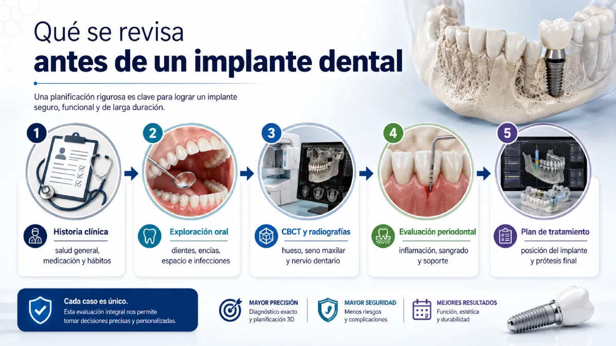 qué se re visa antes de un implante dental infografía
