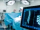 Cómo la neuronavegación y la endoscopia transforman las cirugías de espalda neuronavegación y endoscopia en cirugía de columna
