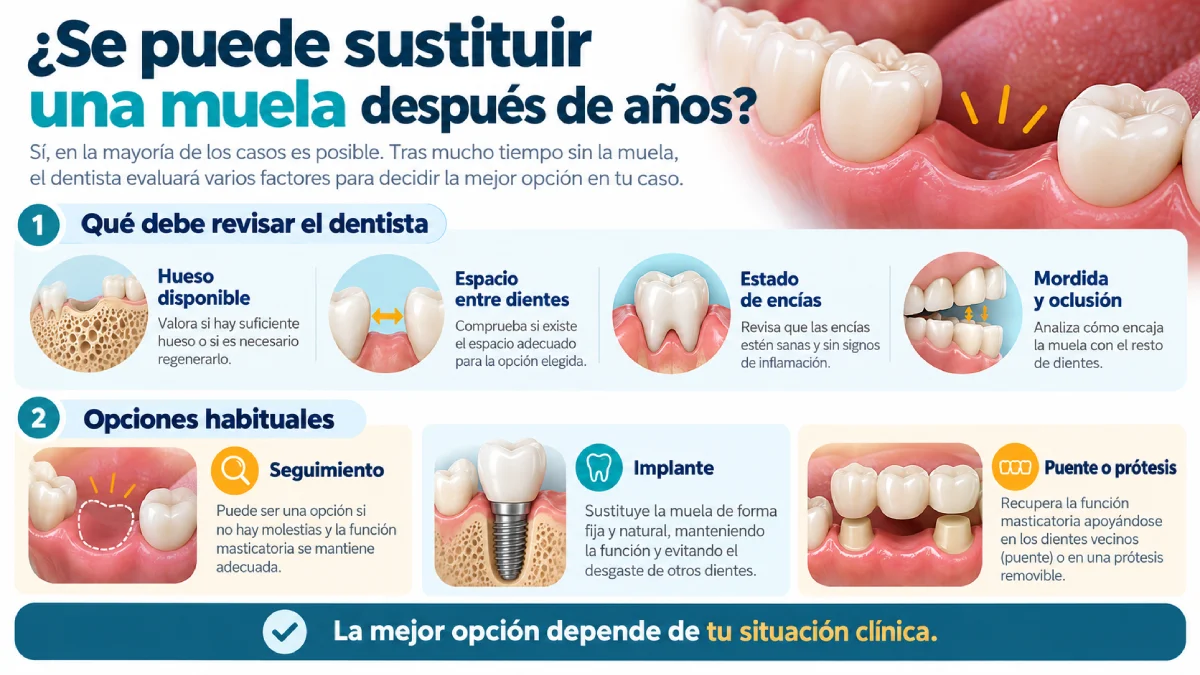 se puede sustituir una muela después de años infografía